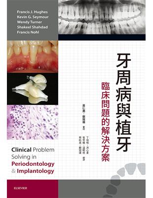 牙周病與植牙 :臨床問題的解決方案 /Francis J. Hughes等著 ; 丁培悅等譯
